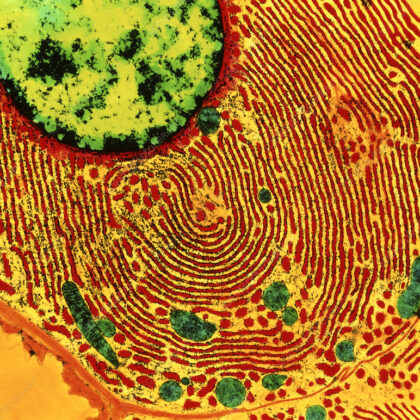 Santé, handicap et inégalités : le cas Luigi Mangione