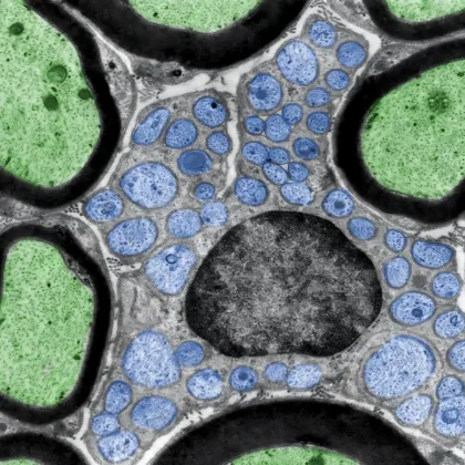 Handicap et crise climatique : tous pris dans la tempête