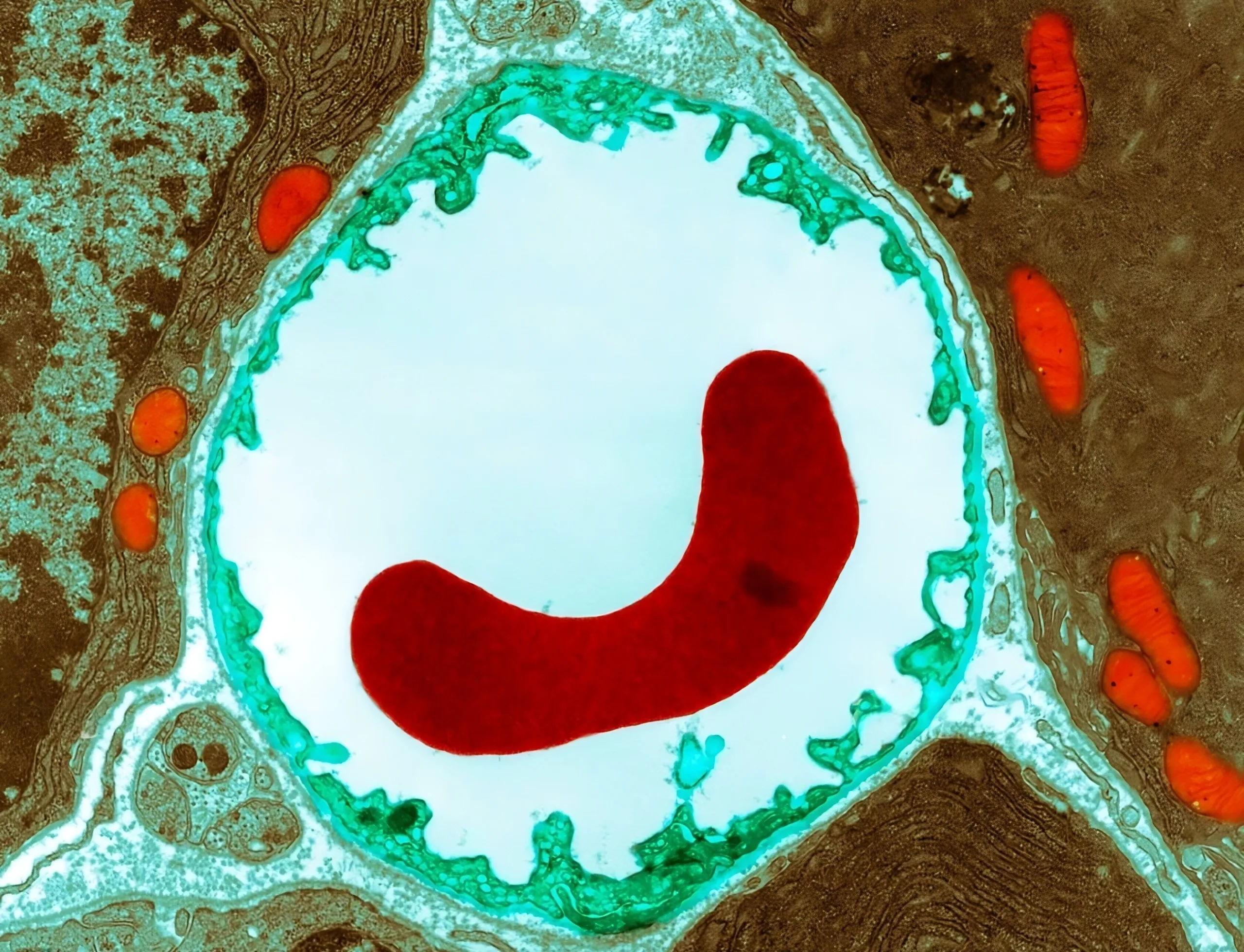 You are currently viewing Chainsaw Man : filiation et contamination deleuzienne