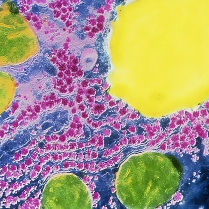 Crip, Éco-crip et Queer : retourner le stigmate