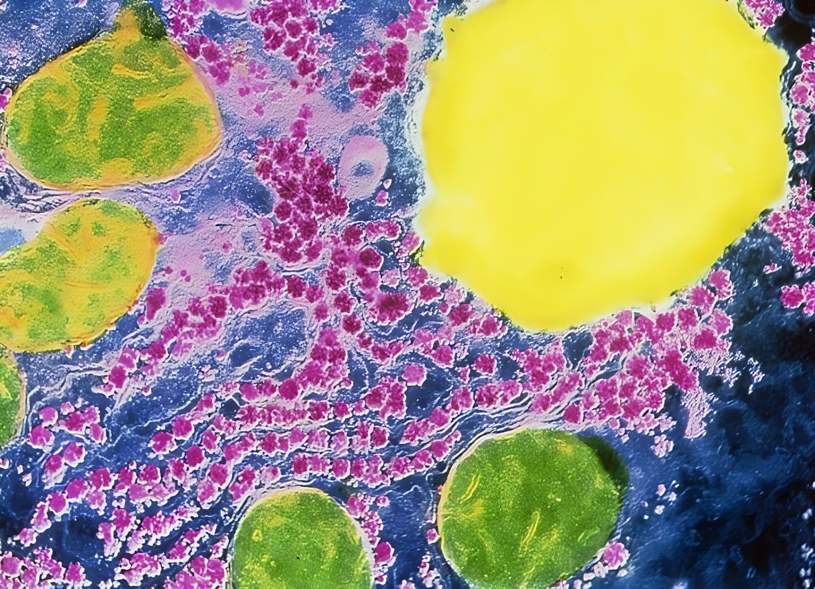 Lire la suite à propos de l’article Crip, Éco-crip et Queer : retourner le stigmate